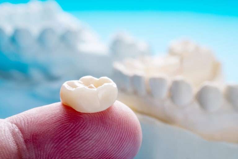 Tooth Crown in Lucknow