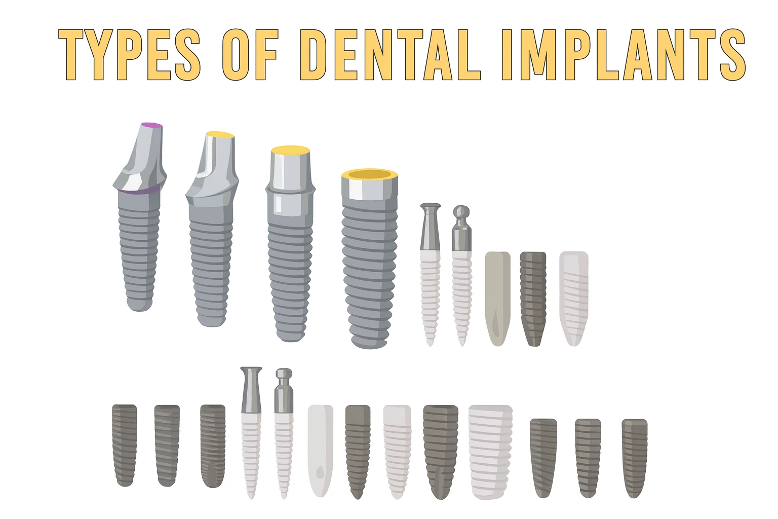 Types of dental implants displayed by Sinha Dental Clinic, showing various implant shapes, sizes, and materials including titanium and ceramic options, used for tooth replacement and advanced implant dentistry.