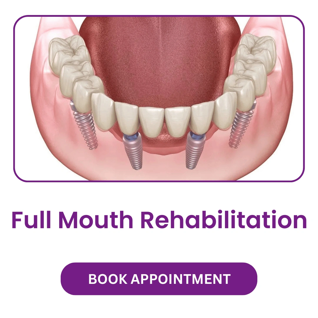 Full Mouth Rehabilitation