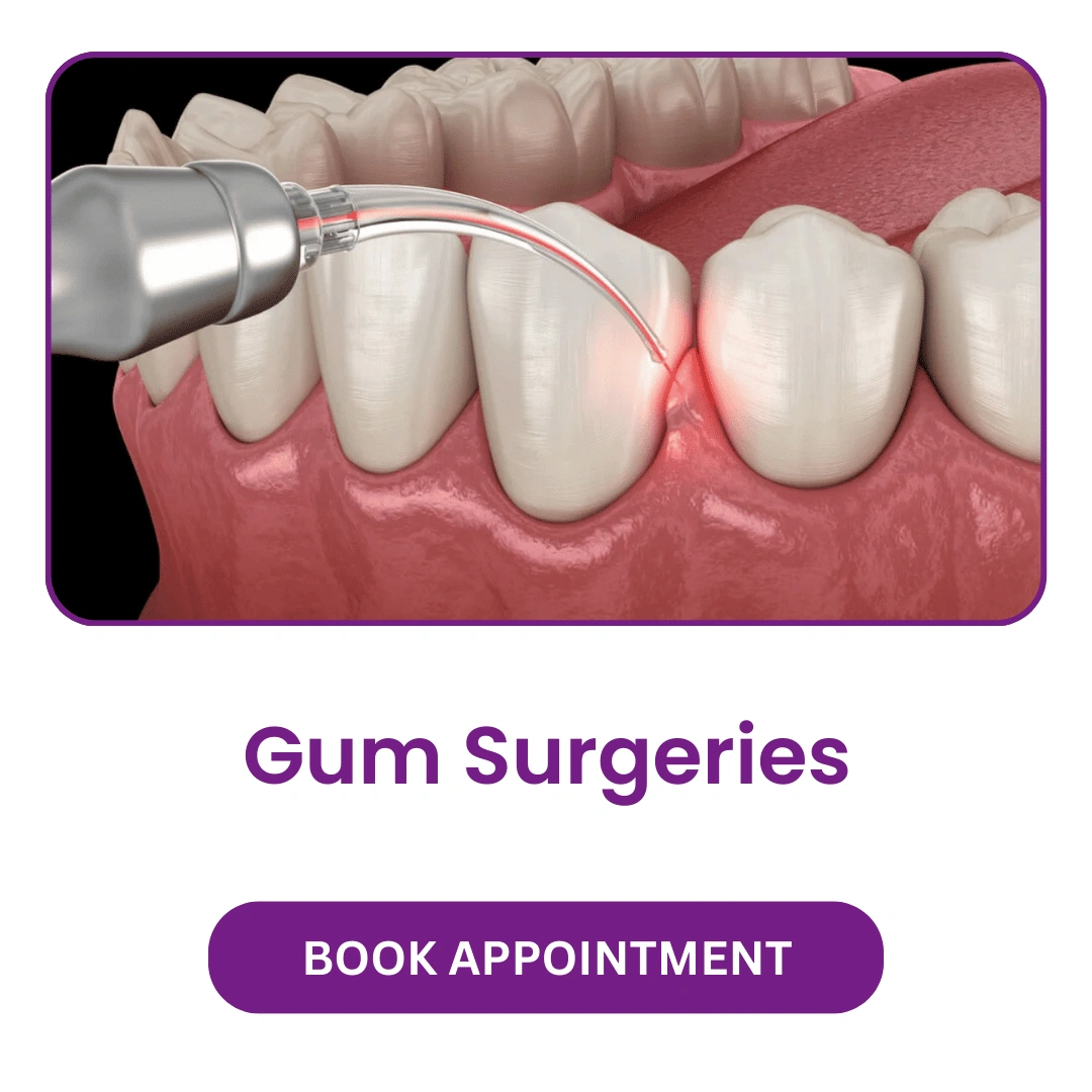 Gum Surgeries