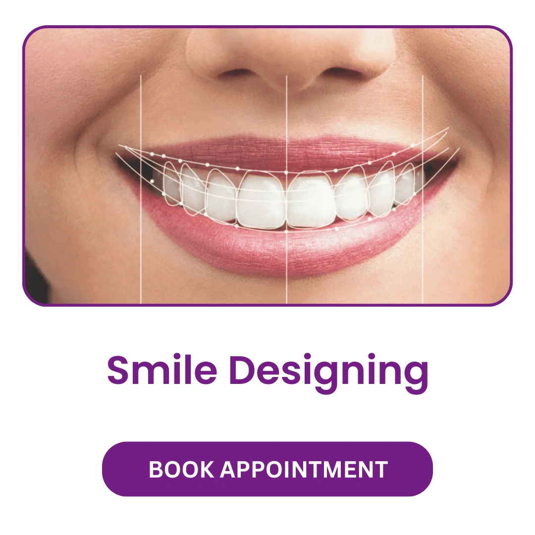 Smile Designing