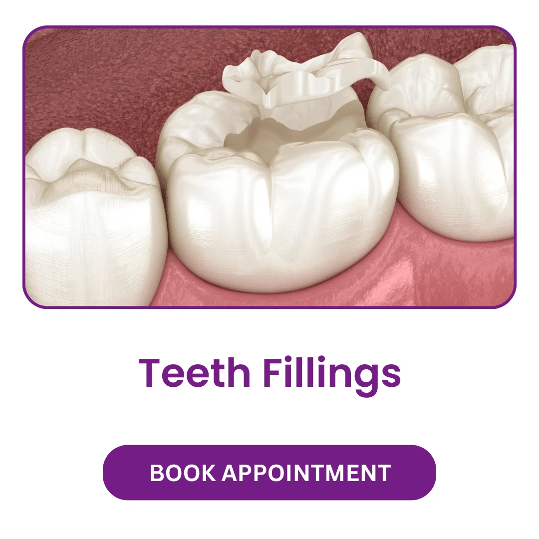 Teeth Fillings