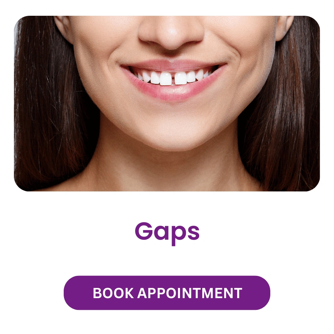 Gaps
