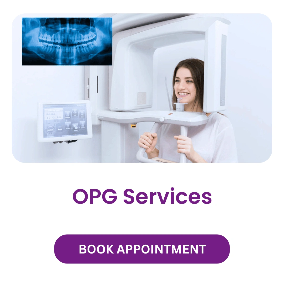 OPG Services