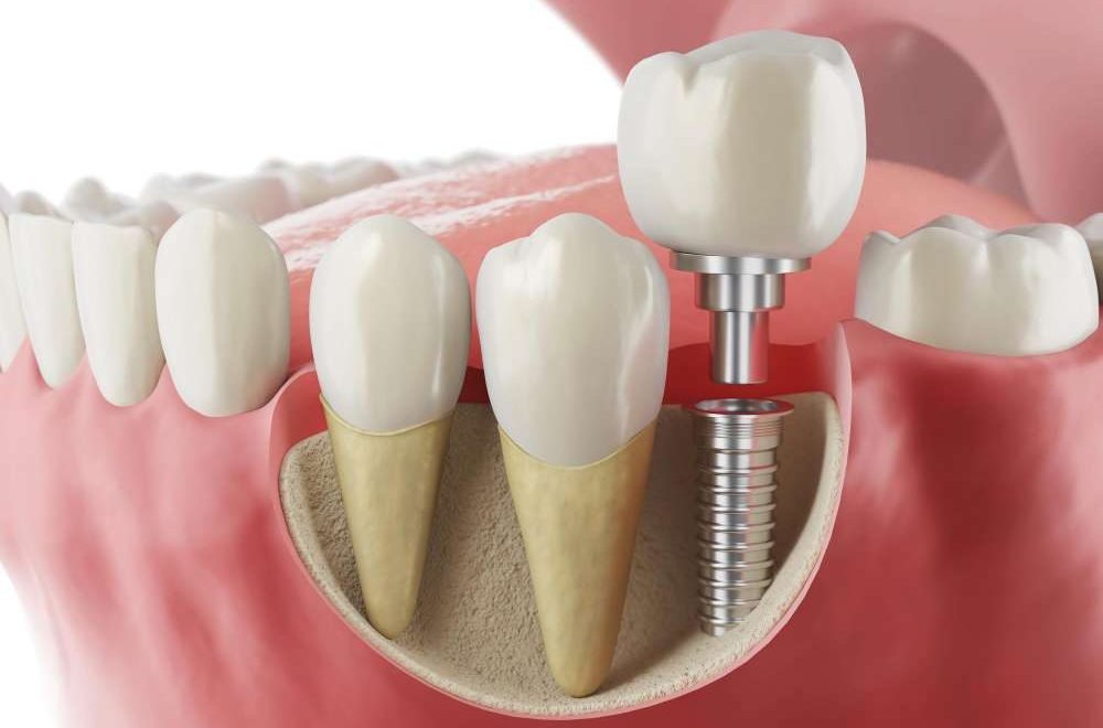 Best Dental Clinic in Lucknow